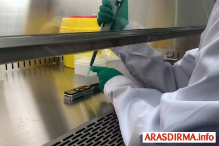Azərbaycanda 163 aktiv koronavirus xəstəsindən 23-nün vəziyyəti ağırdı
