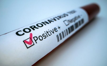 Koronavirusdan ölən jurnalistlərin sayı açıqlandı